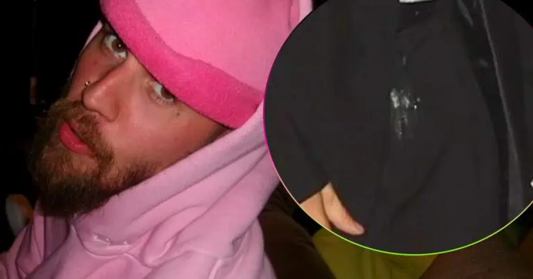 Male portrait featuring hoodie and cap, close-up shot emphasizing facial features and casual attire.